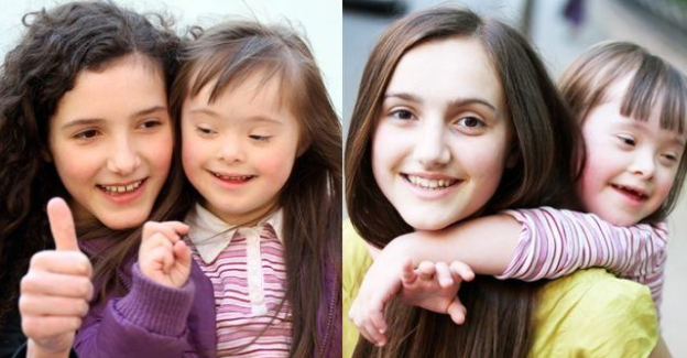 Mengetahui Gejala dan Faktor penyebab Down Syndrome